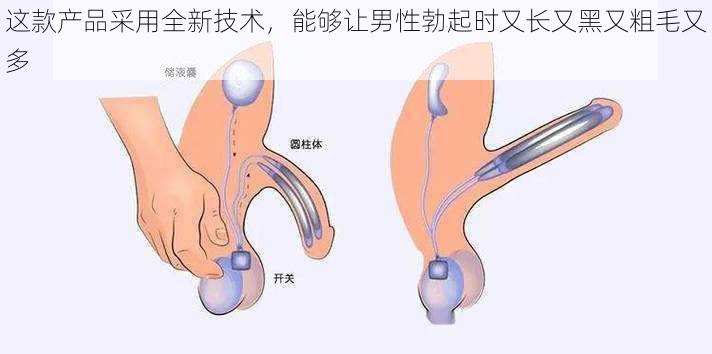 这款产品采用全新技术，能够让男性勃起时又长又黑又粗毛又多