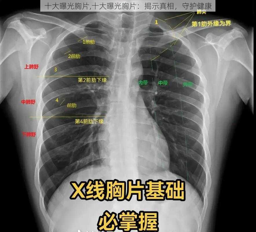 十大曝光胸片,十大曝光胸片：揭示真相，守护健康